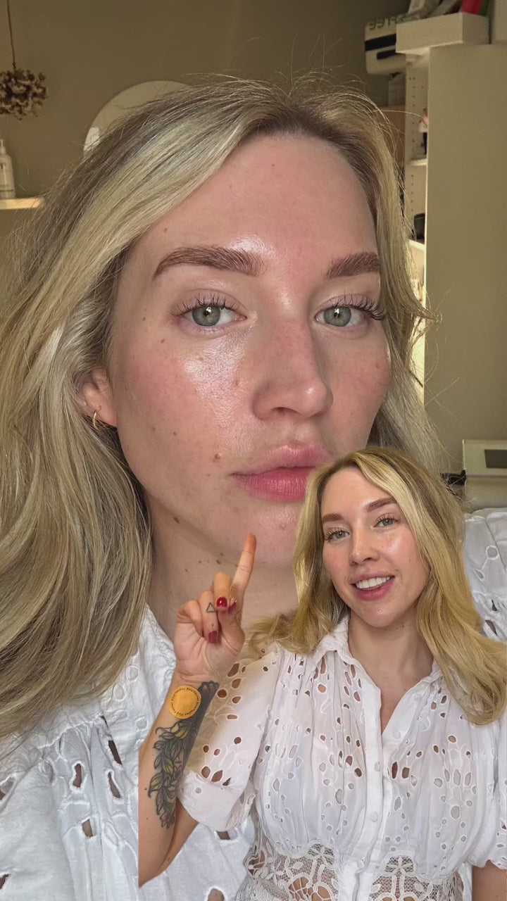 Collagen Patches - Bare skin close-up