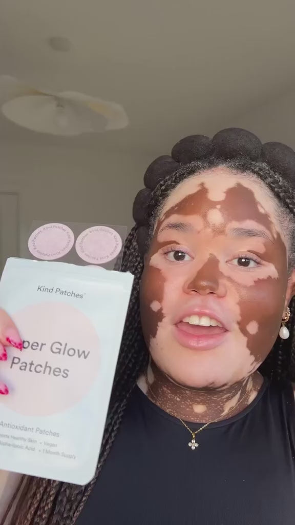 Super Glow Patches - Vitiligo skincare routine